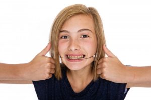 Does Your Child Have An Overbite?